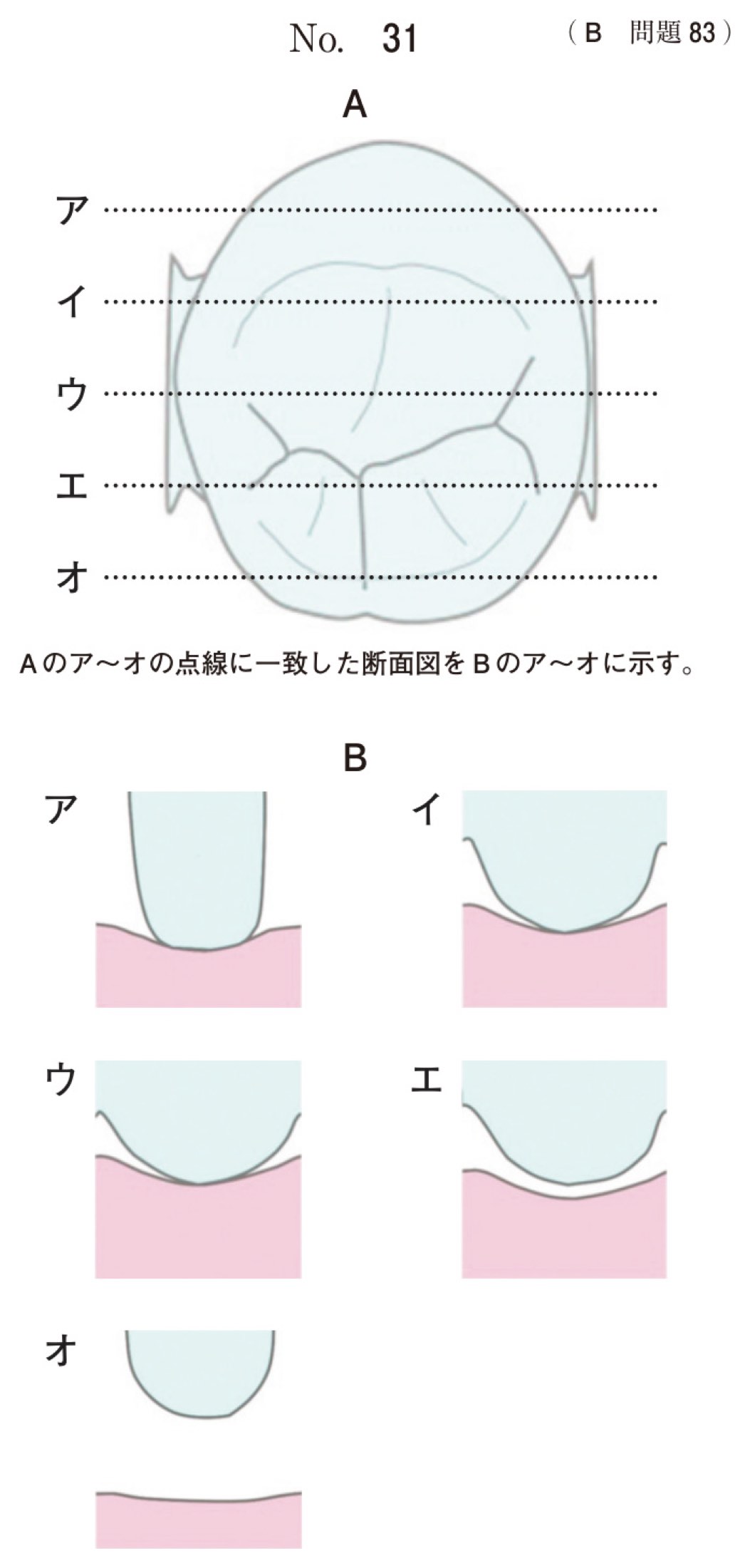 114B083の問題画像