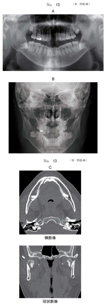 116D045の問題画像