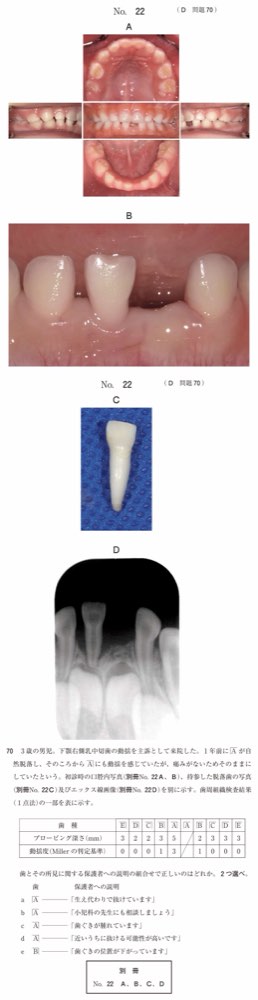 115D070の問題画像