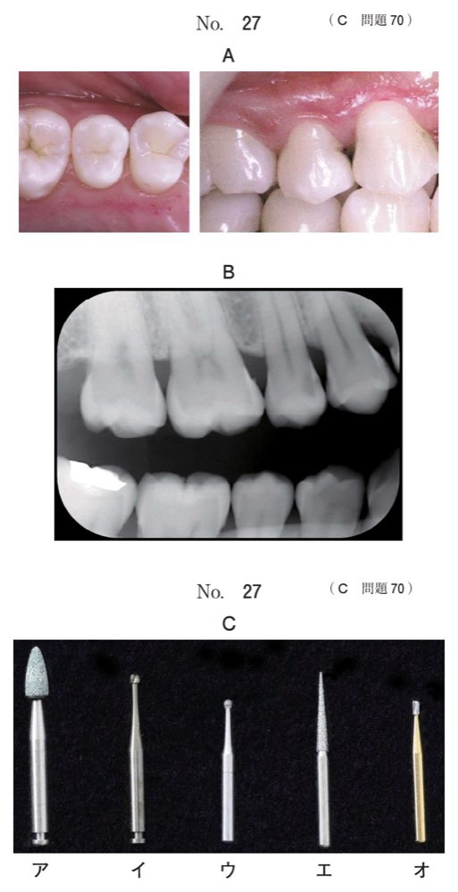 116C070の問題画像