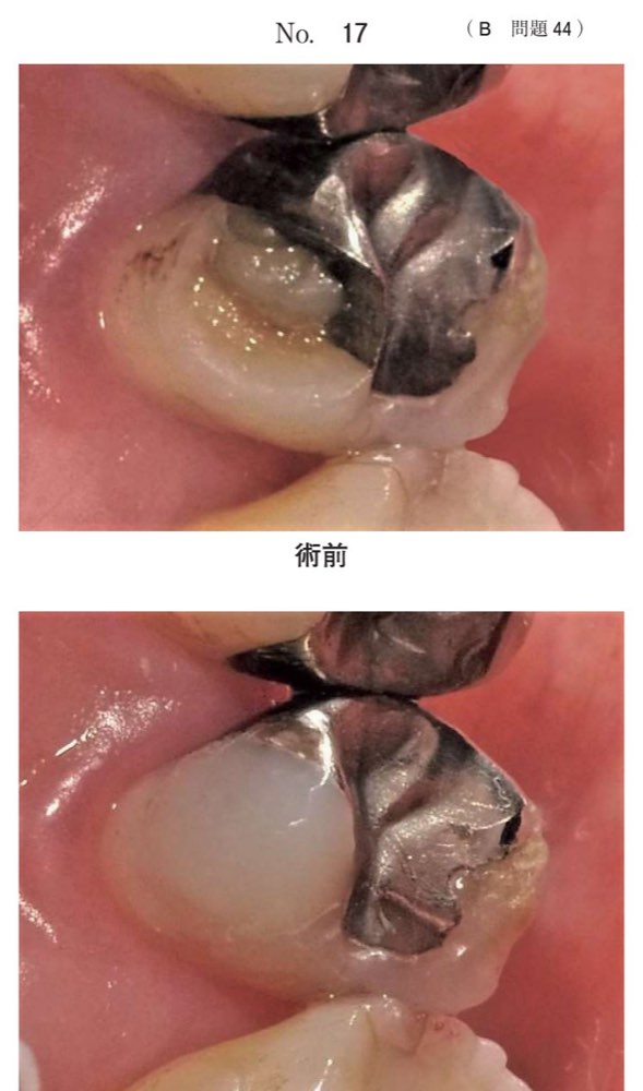 115B044の問題画像