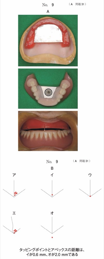 117A031の問題画像