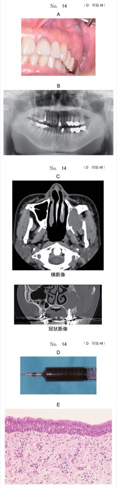 116D049の問題画像