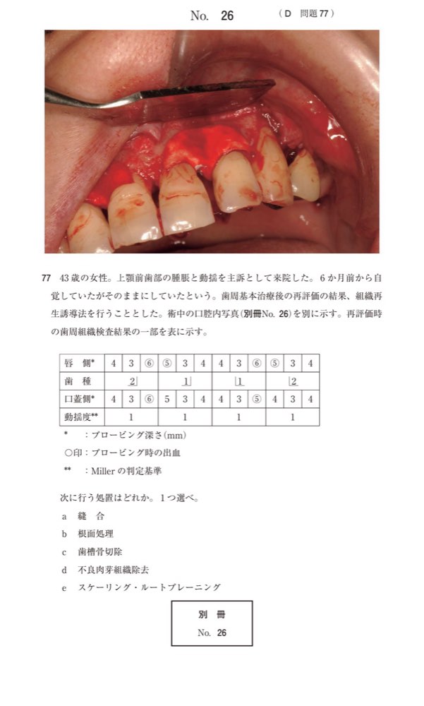 115D077の問題画像