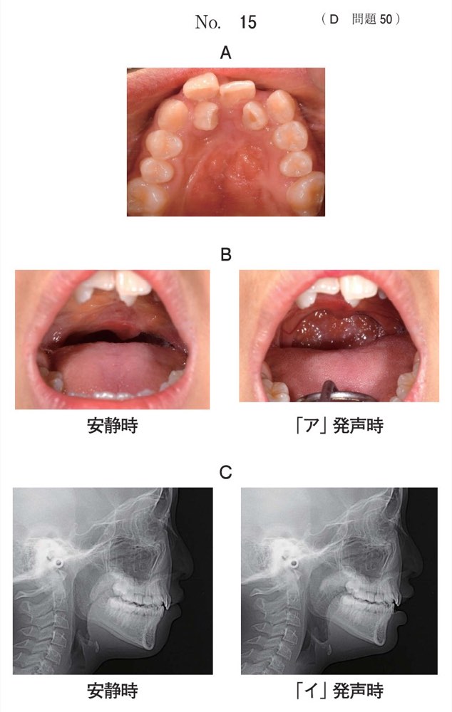 116D050の問題画像