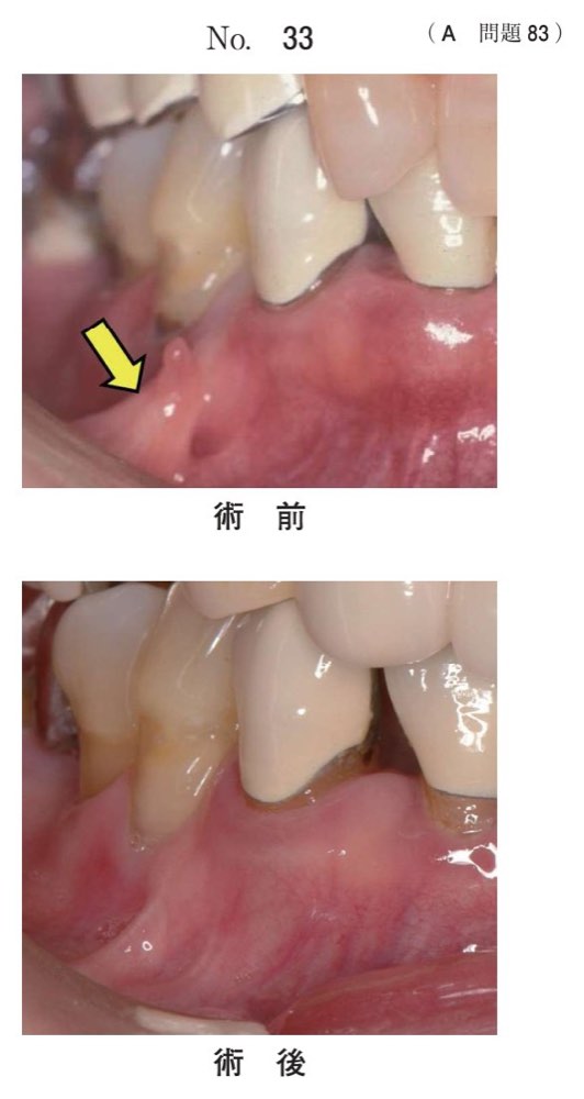 116A083の問題画像