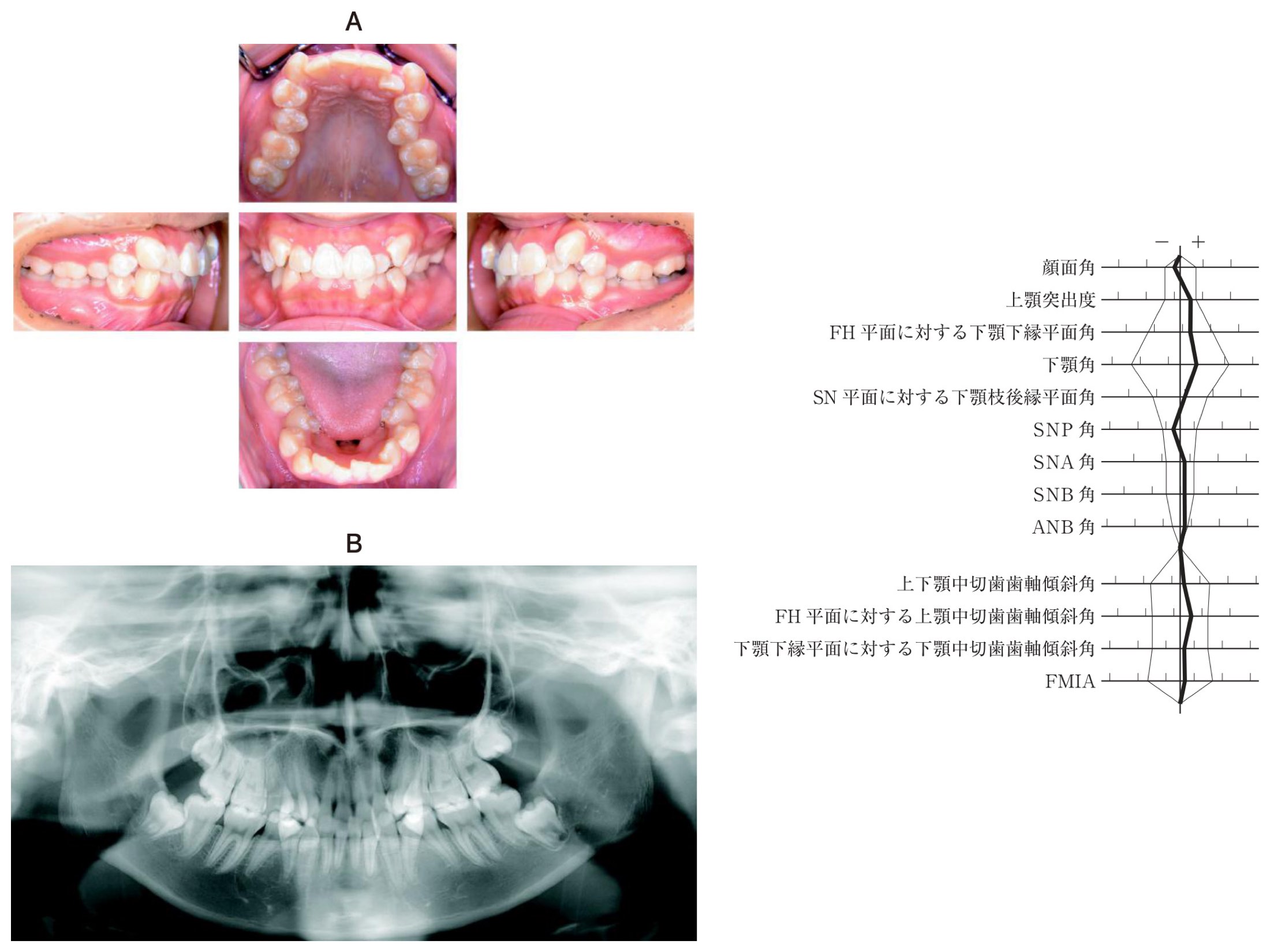 113A054の問題画像