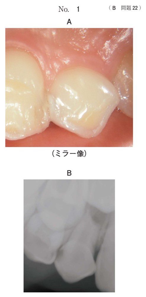 119B022の問題画像