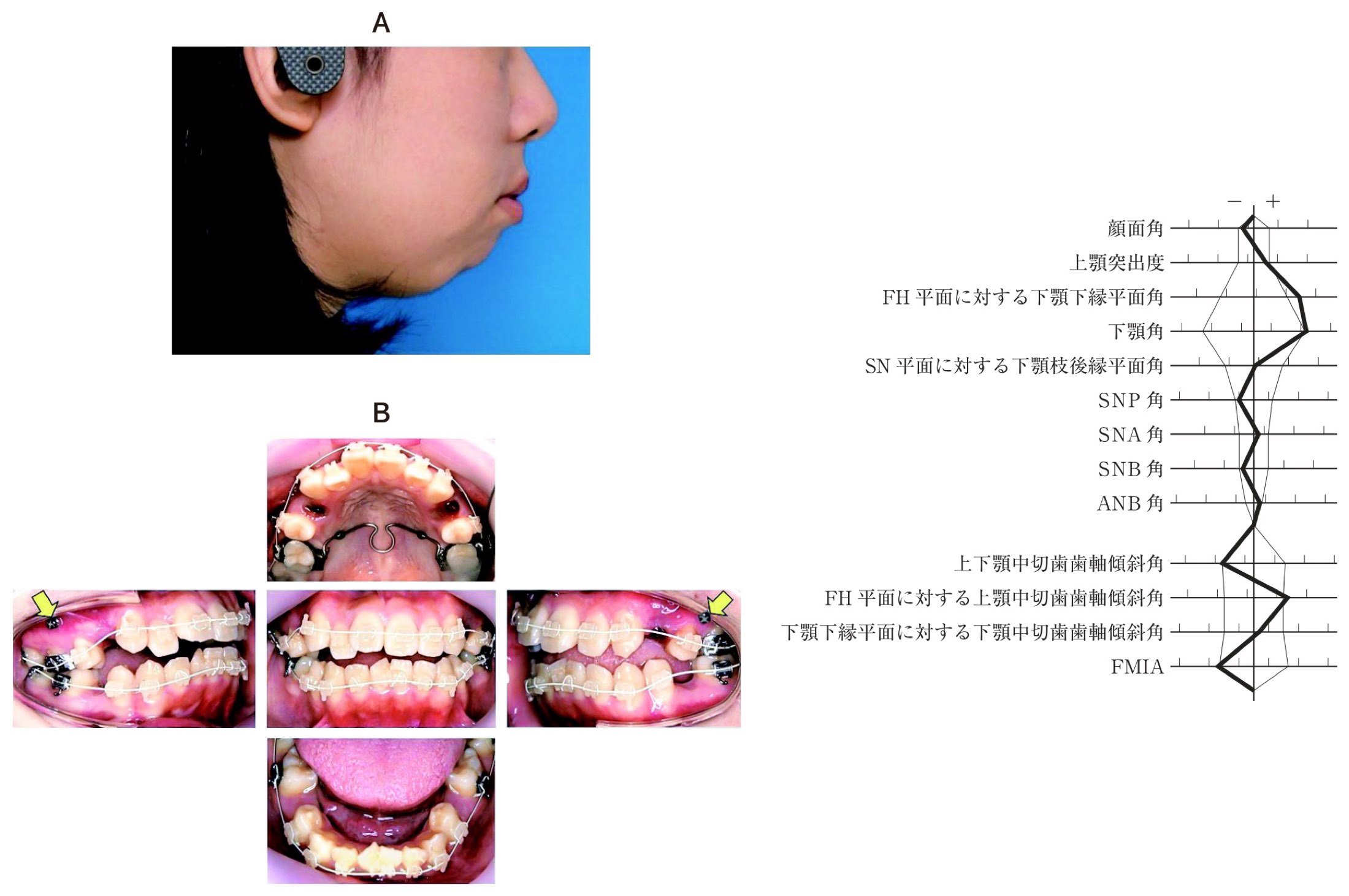 113C084の問題画像