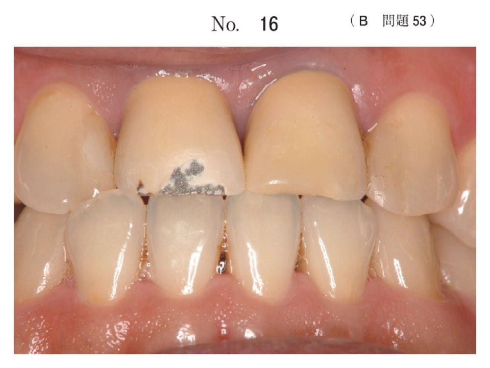117B053の問題画像