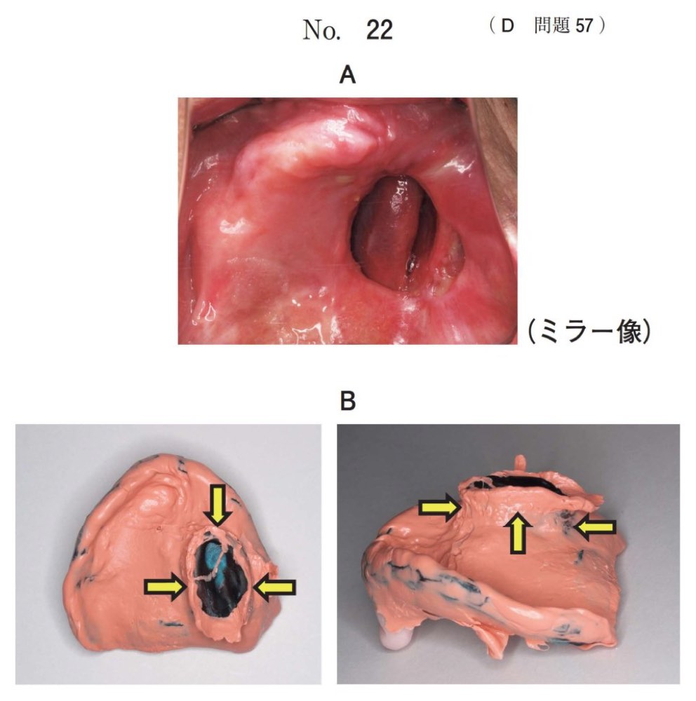 118D057の問題画像
