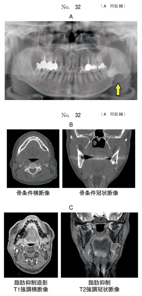 117A088の問題画像