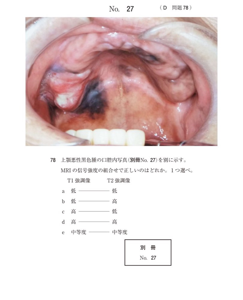 115D078の問題画像