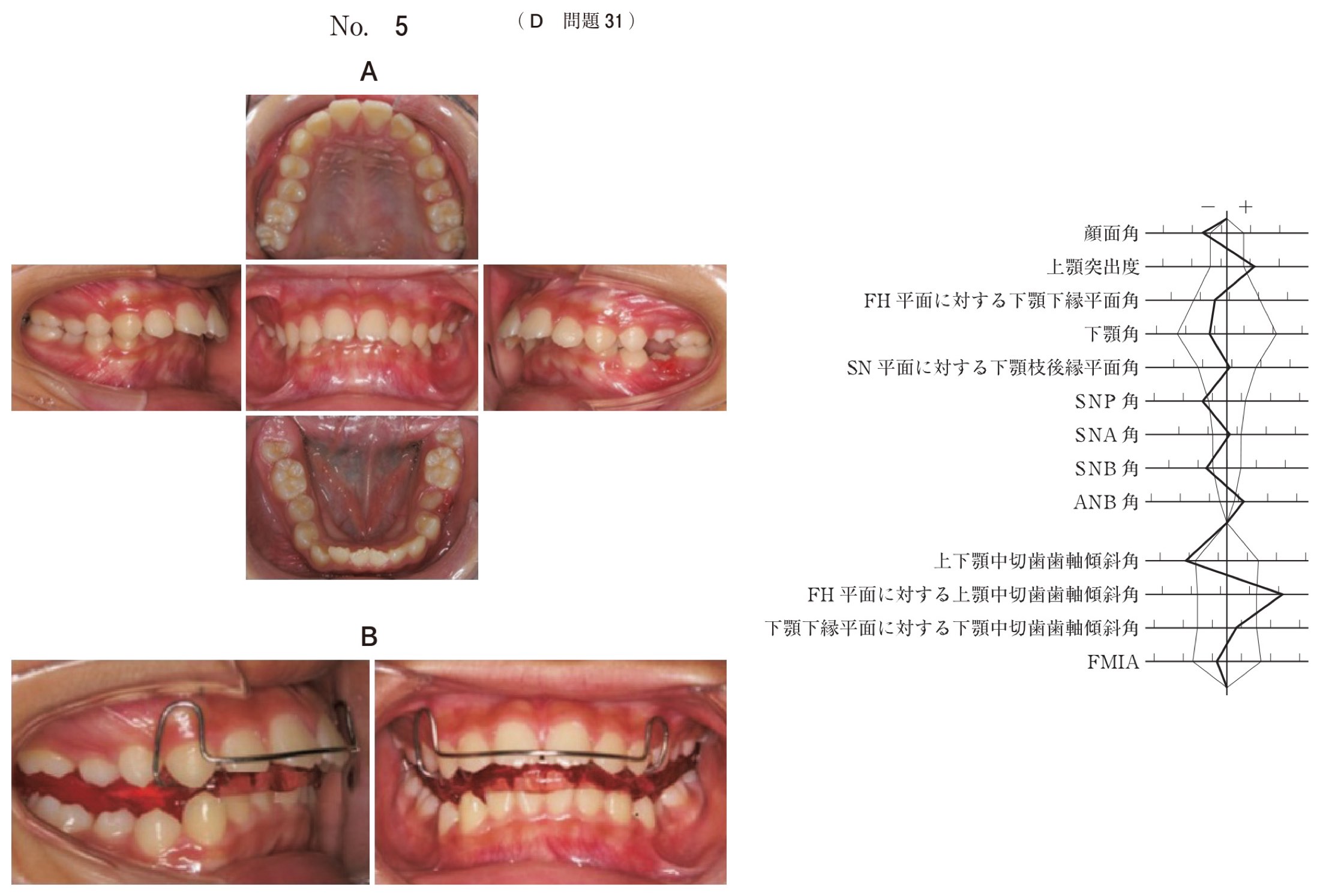 114D031の問題画像
