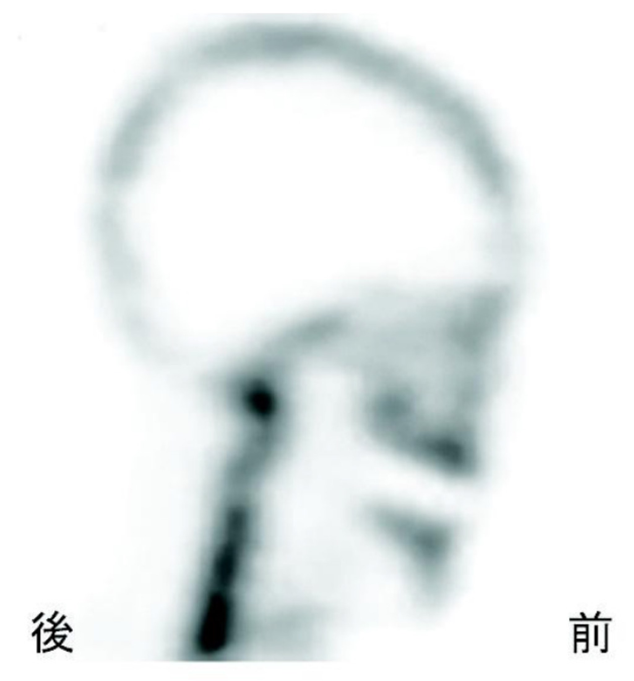 113C044の問題画像