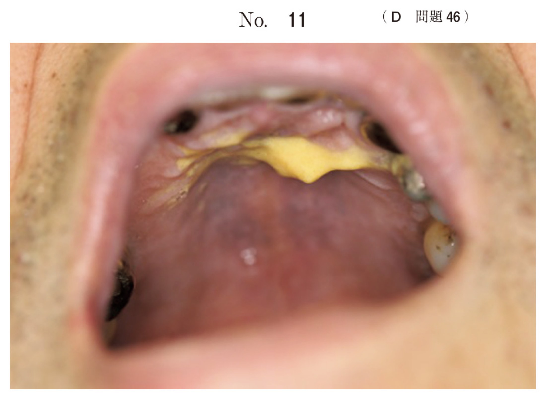 114D046の問題画像