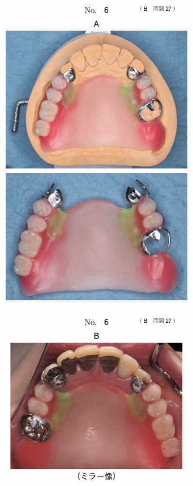 117B027の問題画像