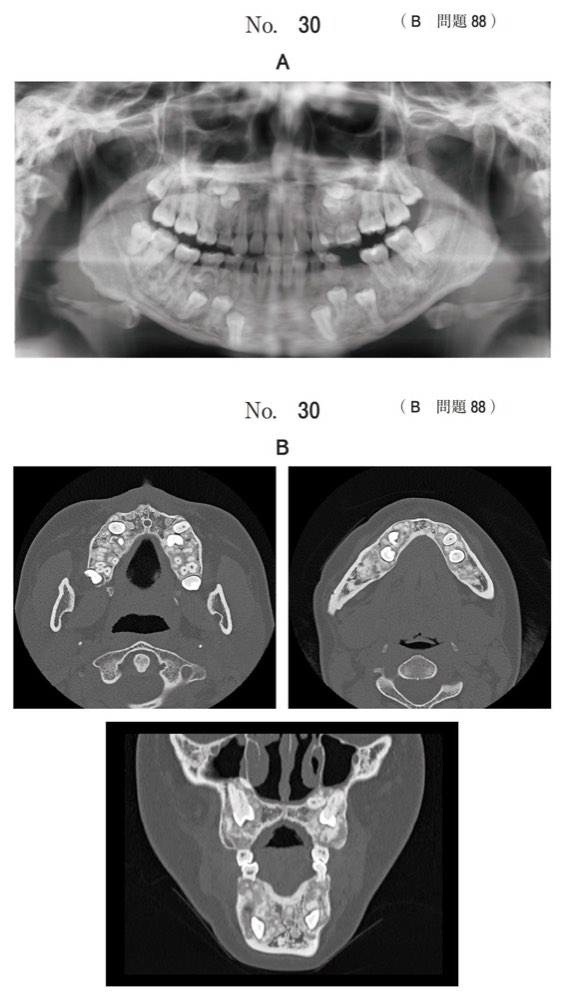 118B088の問題画像