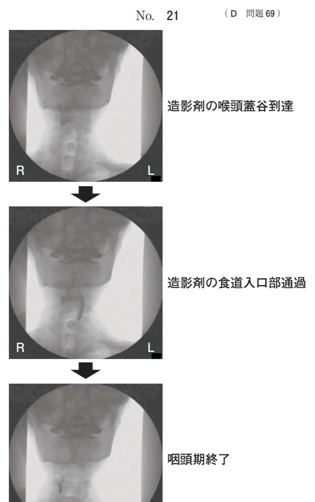 117D069の問題画像
