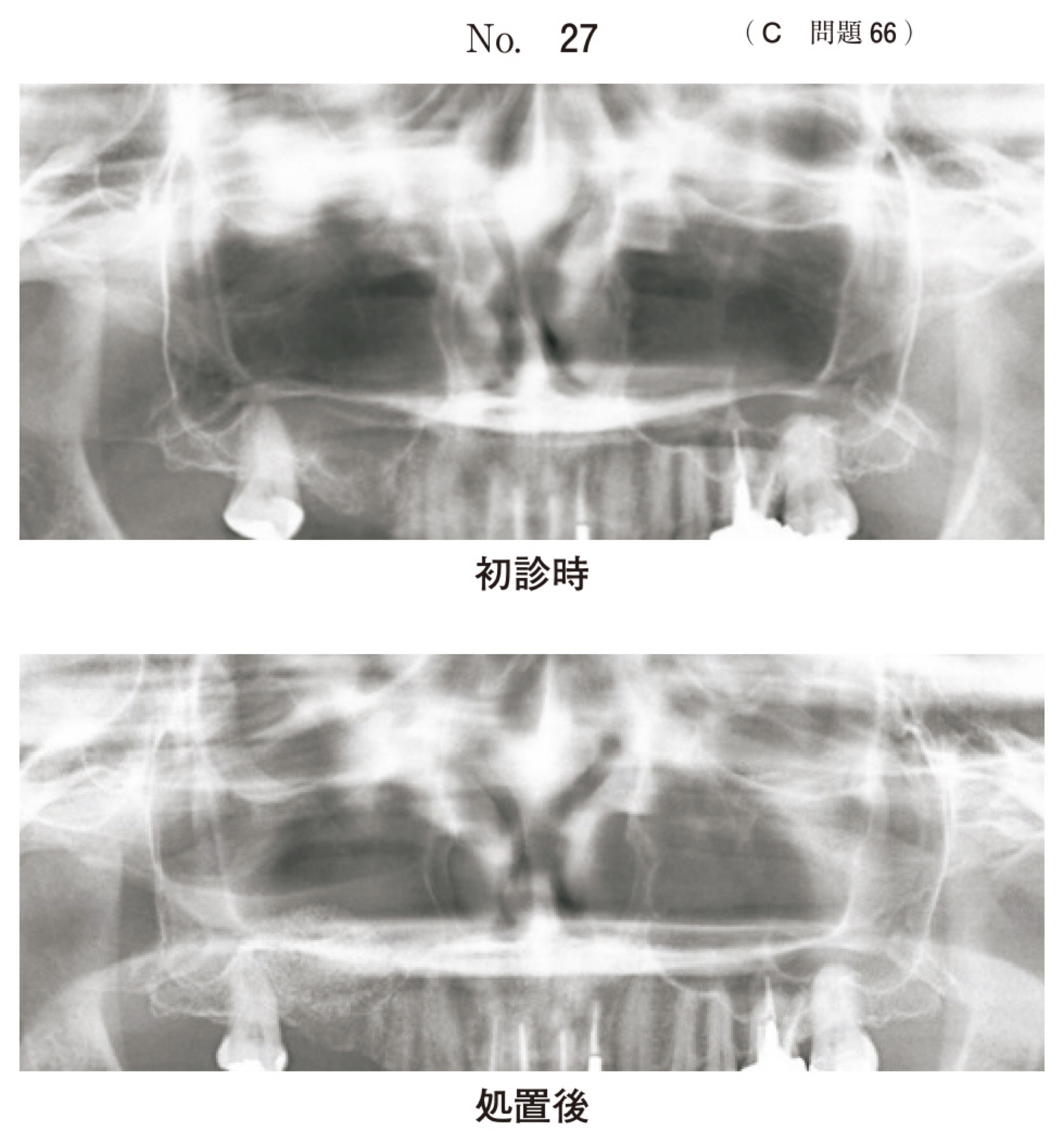 114C066の問題画像
