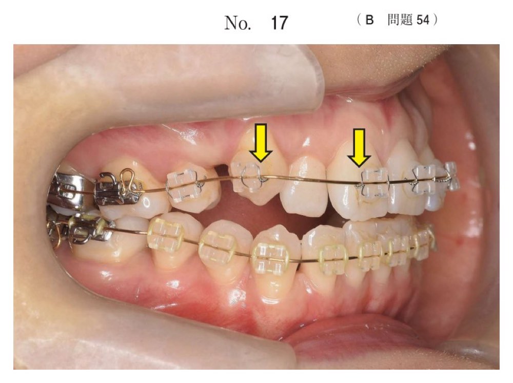 119B054の問題画像
