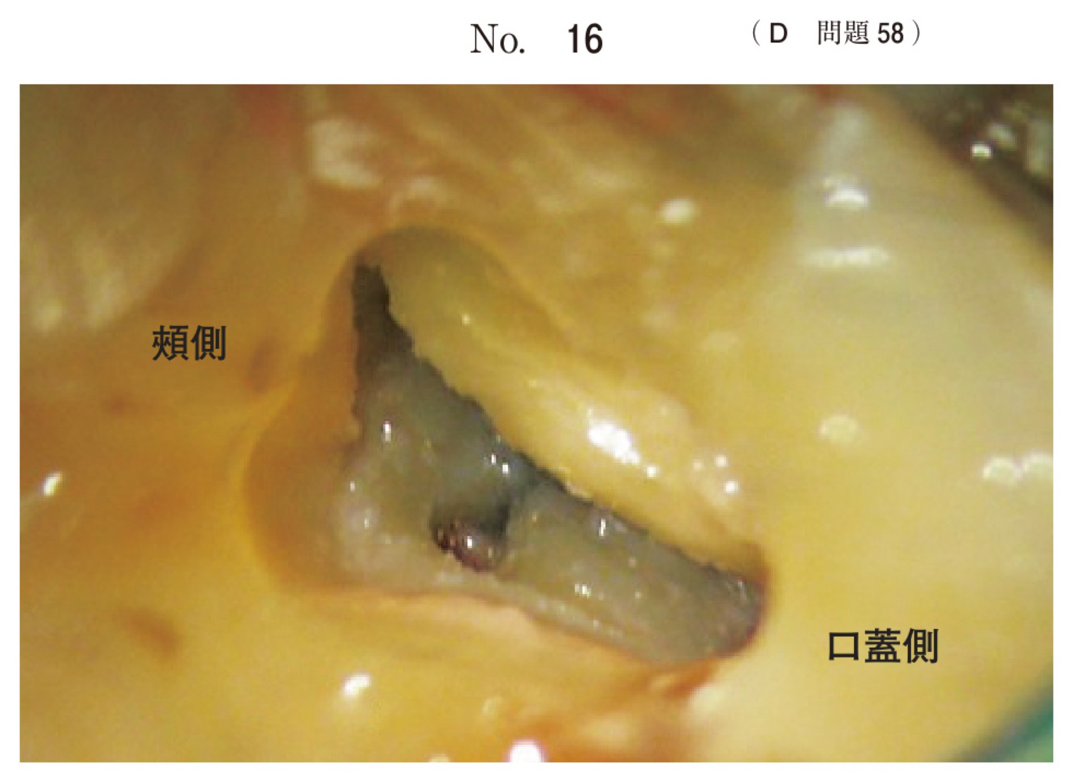 114D058の問題画像