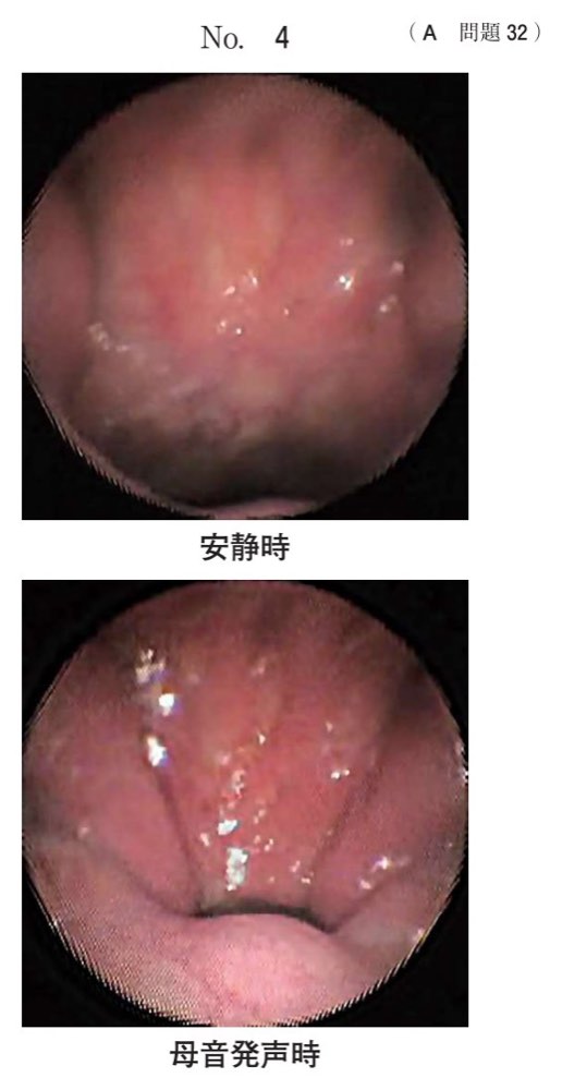 119A032の問題画像