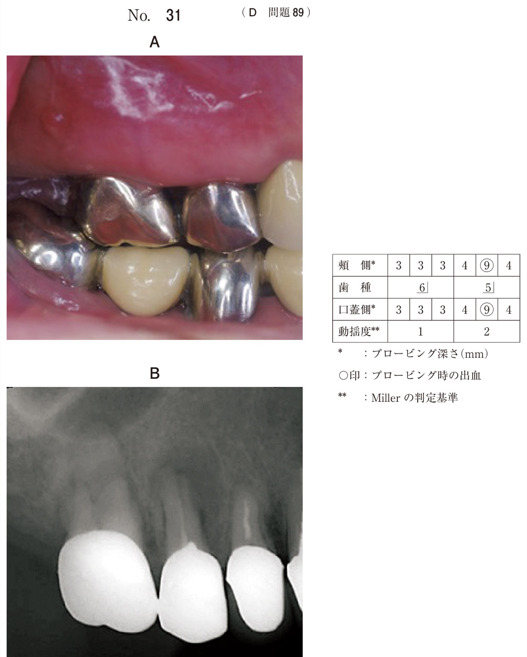 114D089の問題画像