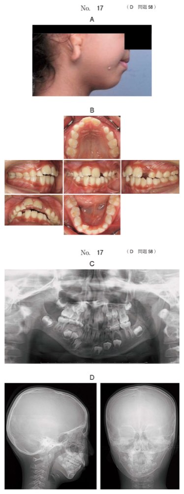 115D058の問題画像