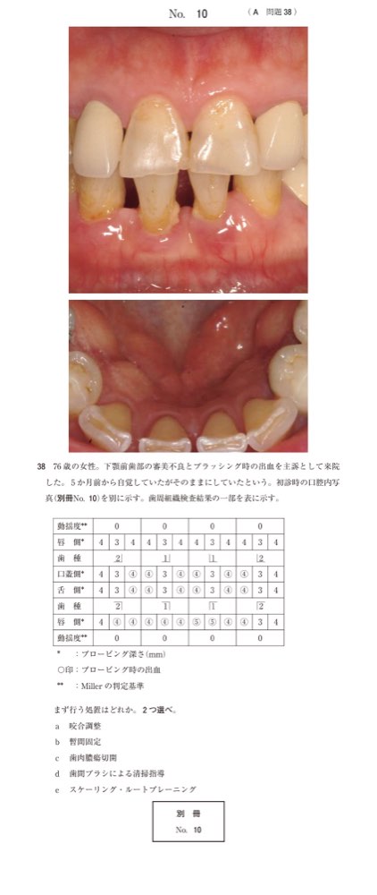 115A038の問題画像