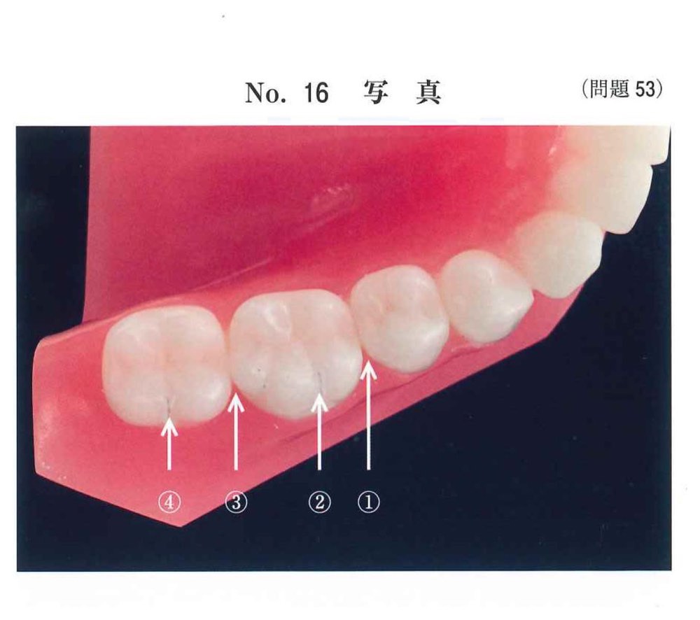 32AM053の問題画像