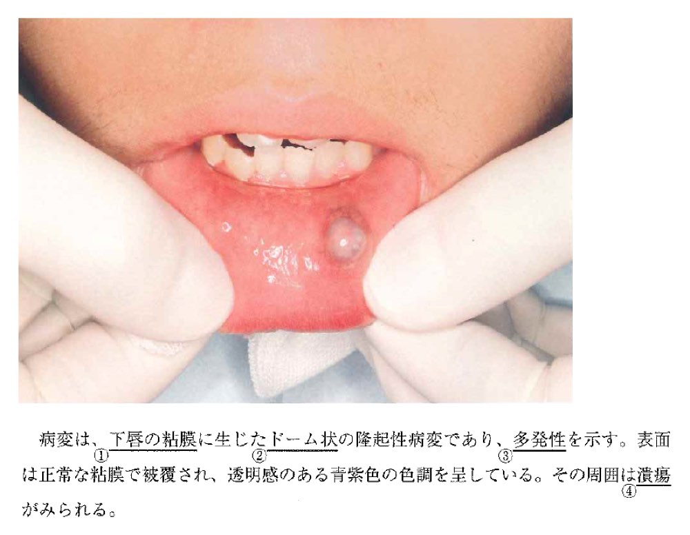 31AM050の問題画像