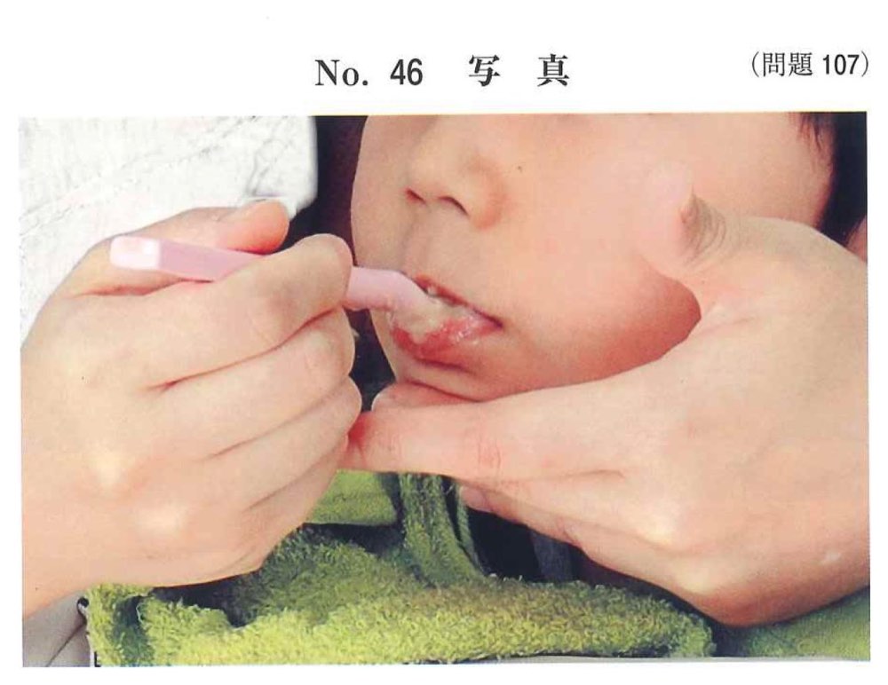 32AM107の問題画像