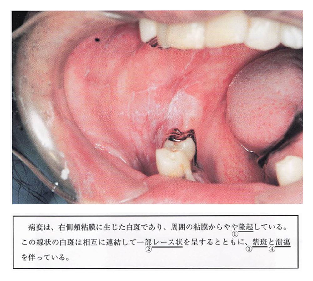 34PM051の問題画像