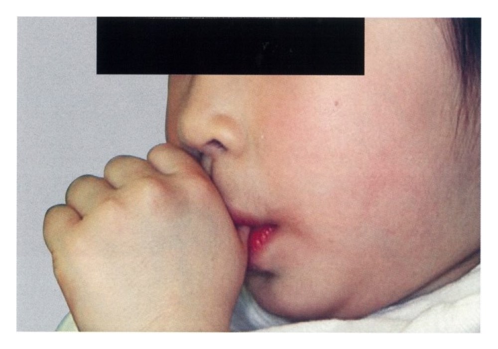 33AM053の問題画像