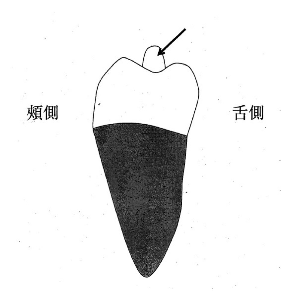 33AM013の問題画像