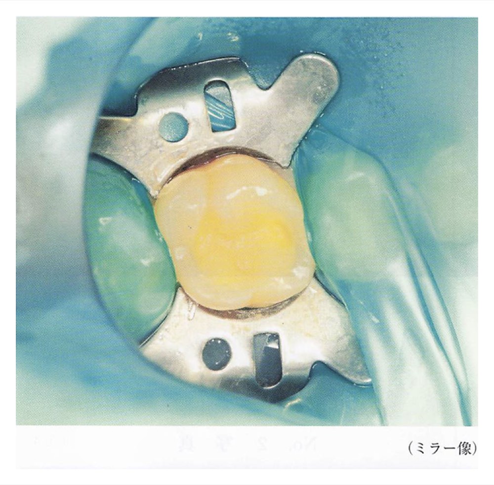 34PM038の問題画像