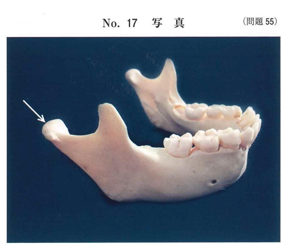 32AM055の問題画像