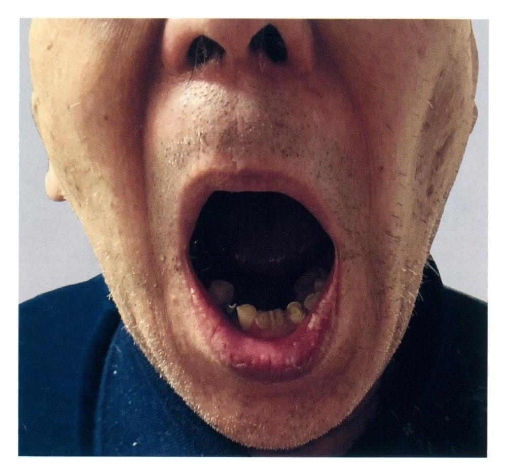 33AM107の問題画像