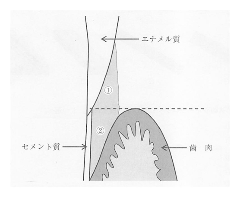 35PM068の問題画像