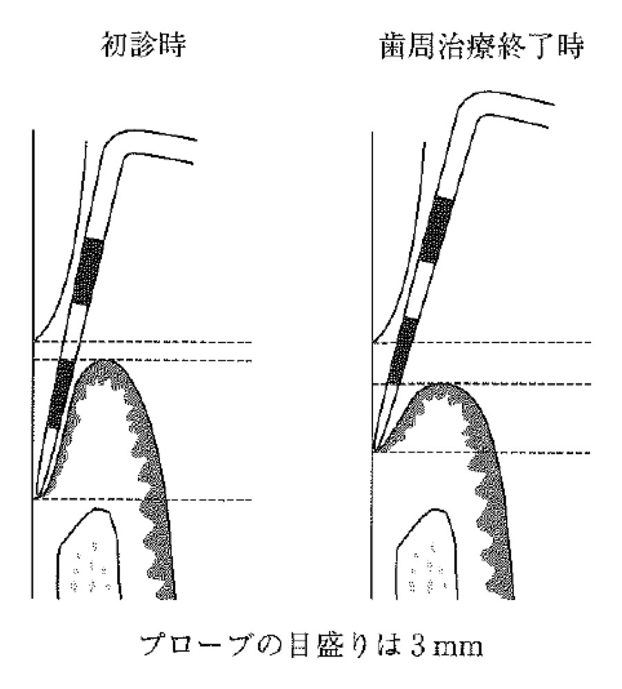31AM065の問題画像