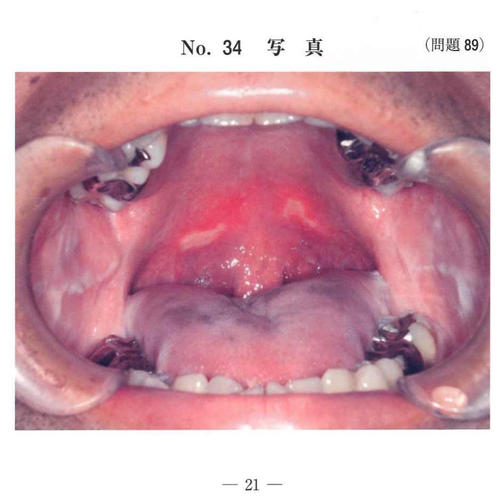 32AM089の問題画像
