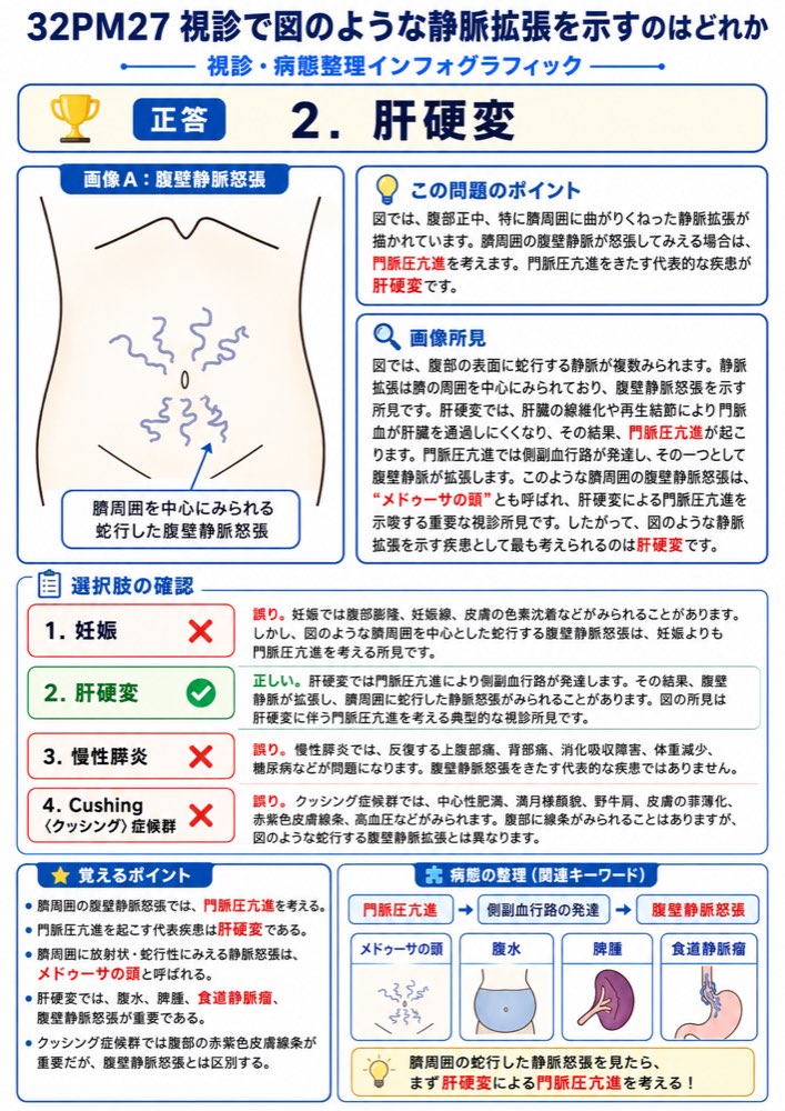 32PM27の解説画像