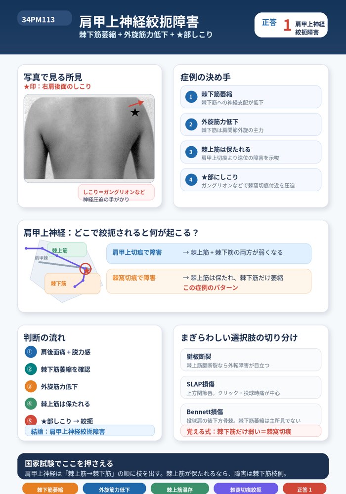 34PM113の解説画像
