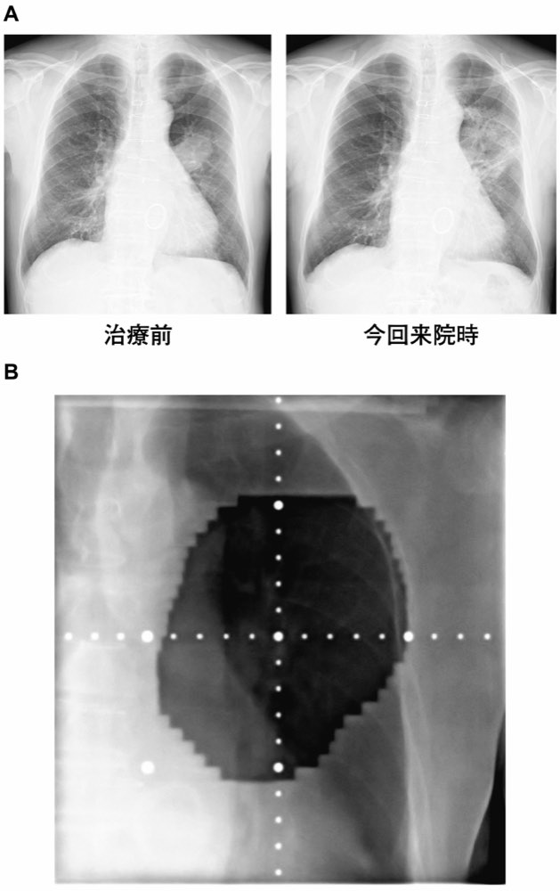 112F47の問題画像
