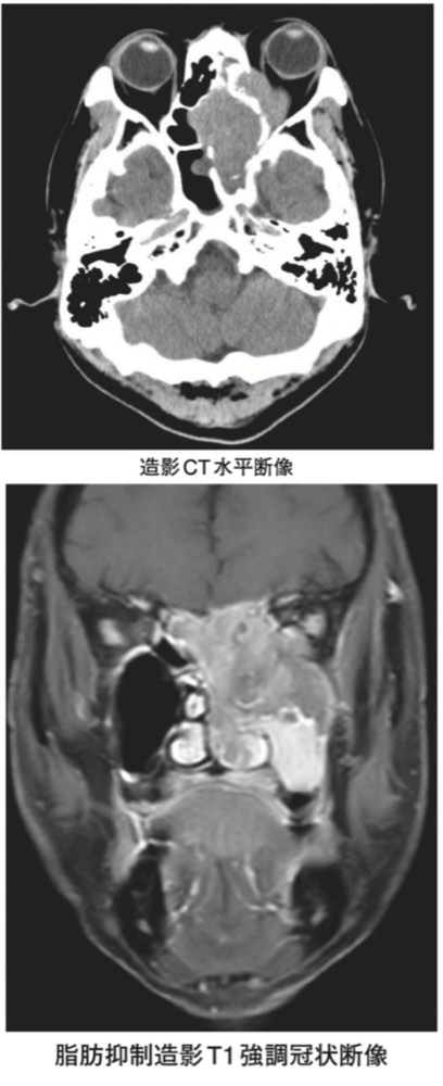 116A58の問題画像