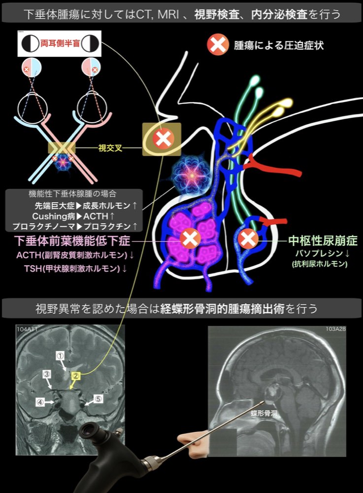 119A15の解説画像
