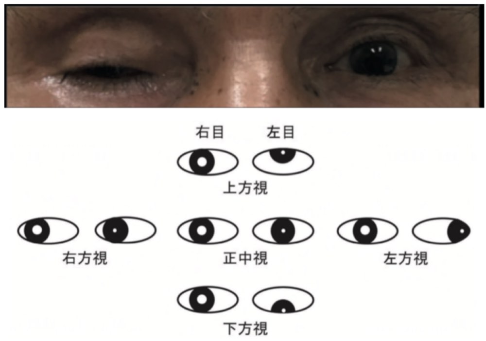 117B39の問題画像
