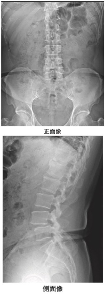 116F35の問題画像