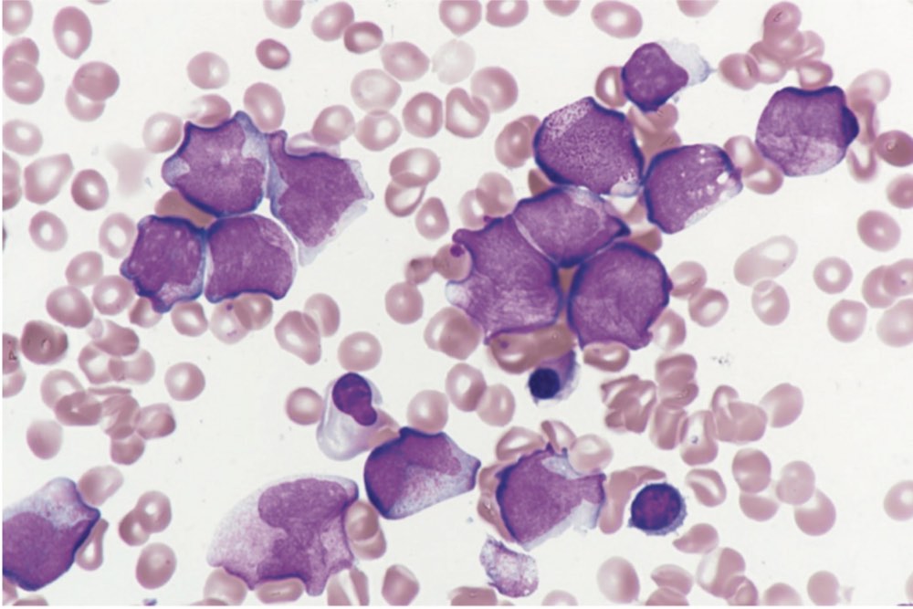 116A23の問題画像